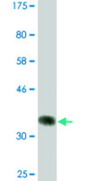 Monoclonal Anti-UBR2, (N-terminal) antibody produced in mouse clone 4G4, ascites fluid
