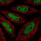 Anti-NR4A2 antibody produced in rabbit Prestige Antibodies&#174; Powered by Atlas Antibodies, affinity isolated antibody, buffered aqueous glycerol solution