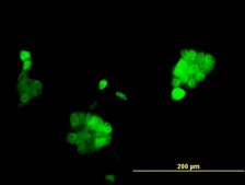 Monoclonal Anti-PGR, (N-terminal) antibody produced in mouse clone 2C2, purified immunoglobulin, buffered aqueous solution