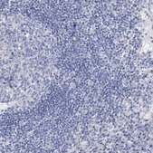 Anti-ANO1 antibody produced in rabbit Prestige Antibodies&#174; Powered by Atlas Antibodies, affinity isolated antibody, buffered aqueous glycerol solution