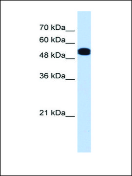 Anti-UGP2 antibody produced in rabbit affinity isolated antibody