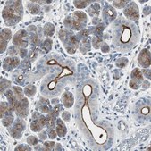 Anti-PIGR antibody produced in rabbit Prestige Antibodies&#174; Powered by Atlas Antibodies, affinity isolated antibody, buffered aqueous glycerol solution, Ab1