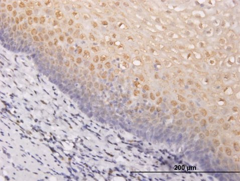 ANTI-PIM1 antibody produced in mouse clone 3F5, purified immunoglobulin, buffered aqueous solution