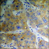 Anti-phospho-p70 S6 Kinase (pThr389) antibody produced in rabbit affinity isolated antibody