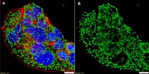 Anti-Mitochondria Antibody, clone 113-1 ZooMAb&#174; Mouse Monoclonal recombinant, expressed in HEK 293 cells