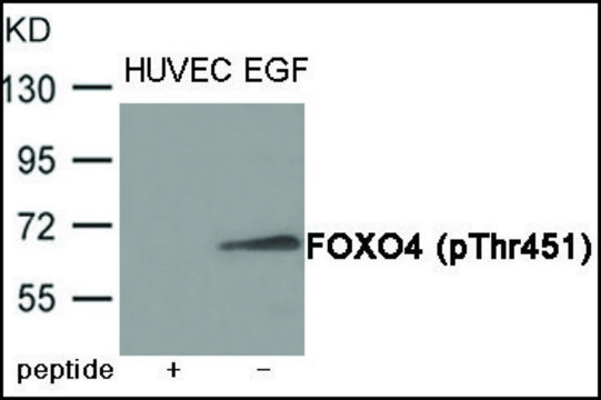 Anti-phospho-FOXO4 (pThr451) antibody produced in rabbit affinity isolated antibody