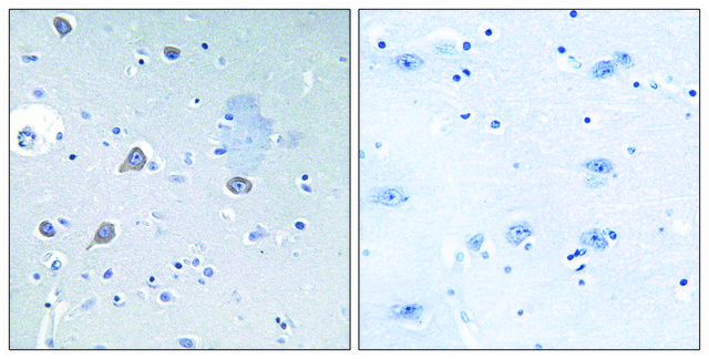 Anti-p70 S6 Kinase antibody produced in rabbit affinity isolated antibody