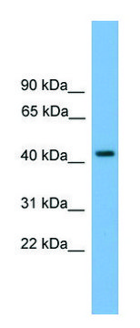 Anti-PALM (N-terminal) antibody produced in rabbit affinity isolated antibody