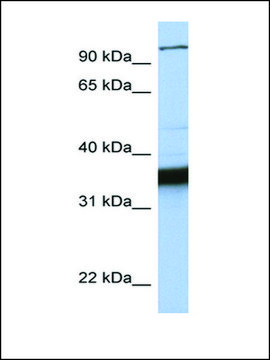 Anti-KIFC3 antibody produced in rabbit affinity isolated antibody