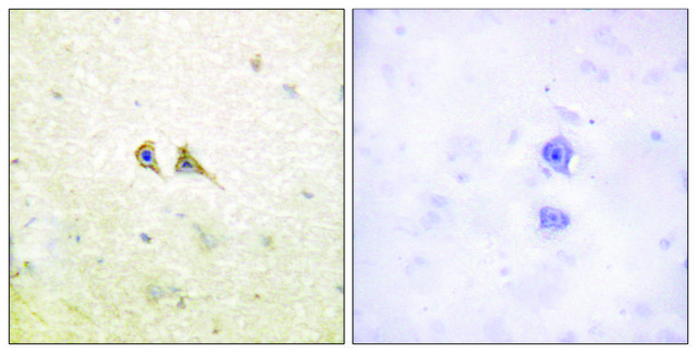 Anti-FAS LIGAND antibody produced in rabbit affinity isolated antibody