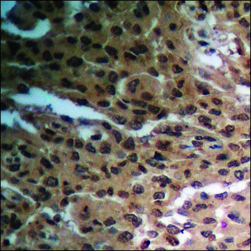 Anti-phospho-RAD52 (pTyr104) antibody produced in rabbit affinity isolated antibody