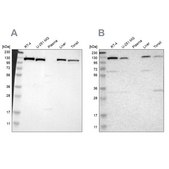 Anti-PITRM1 antibody produced in rabbit Ab2, Prestige Antibodies&#174; Powered by Atlas Antibodies, affinity isolated antibody, buffered aqueous glycerol solution