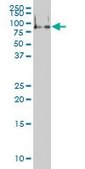 Monoclonal Anti-FMR1 antibody produced in mouse clone 2D4, purified immunoglobulin, buffered aqueous solution