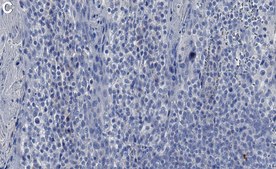 Anti-MRP-8/14 Antibody, clone AHN-17 ZooMAb&#174; Mouse Monoclonal recombinant, expressed in HEK 293 cells