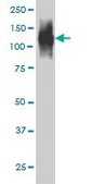 Monoclonal Anti-FAP antibody produced in mouse clone 1E5, purified immunoglobulin, buffered aqueous solution