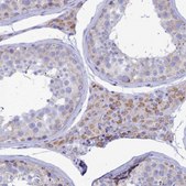 Anti-TMEM206 antibody produced in rabbit Prestige Antibodies&#174; Powered by Atlas Antibodies, affinity isolated antibody, buffered aqueous glycerol solution