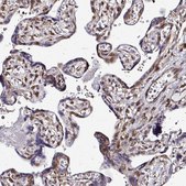 Anti-FMR1 antibody produced in rabbit Prestige Antibodies&#174; Powered by Atlas Antibodies, affinity isolated antibody, buffered aqueous glycerol solution