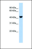 Anti-TH, (N-terminal) antibody produced in rabbit affinity isolated antibody