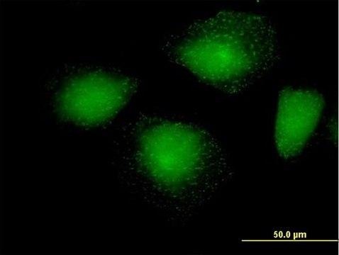 Anti-HIP1R antibody produced in mouse purified immunoglobulin, buffered aqueous solution