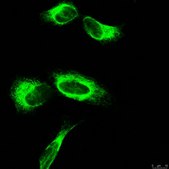 Anti-APP A4 Antibody, a.a. 66-81 of APP {NT}, clone 22C11 clone 22C11, Chemicon&#174;, from mouse