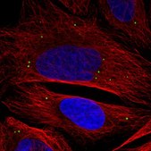Anti-ADAMTSL3 antibody produced in rabbit Prestige Antibodies&#174; Powered by Atlas Antibodies, affinity isolated antibody, buffered aqueous glycerol solution