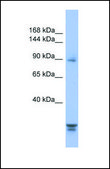 Anti-PPP2R3A, (N-terminal) antibody produced in rabbit affinity isolated antibody