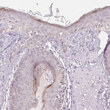 Anti-KPRP antibody produced in rabbit Prestige Antibodies&#174; Powered by Atlas Antibodies, affinity isolated antibody, buffered aqueous glycerol solution
