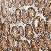 Anti-PCDH7 antibody produced in rabbit Prestige Antibodies&#174; Powered by Atlas Antibodies, affinity isolated antibody, buffered aqueous glycerol solution