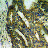 Anti-phospho-CDK5 (pTyr15) antibody produced in rabbit affinity isolated antibody