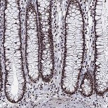 Anti-PNISR antibody produced in rabbit Prestige Antibodies&#174; Powered by Atlas Antibodies, affinity isolated antibody, buffered aqueous glycerol solution