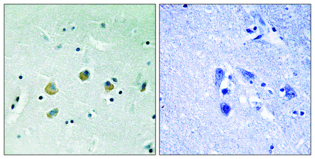 Anti-phospho-MAP3K8 (pSer400) antibody produced in rabbit affinity isolated antibody