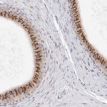 Anti-YIPF3 antibody produced in rabbit Prestige Antibodies&#174; Powered by Atlas Antibodies, affinity isolated antibody