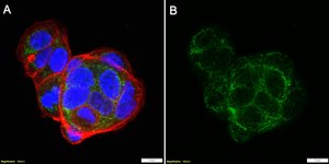 Anti-CPT2 Antibody, clone 1G7 ZooMAb&#174; Rabbit Monoclonal recombinant, expressed in HEK 293 cells