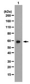 Anti-U1-70K Antibody from rabbit