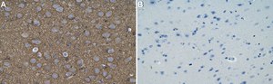 Anti-Tau Antibody, clone T49 ZooMAb&#174; Mouse Monoclonal recombinant, expressed in HEK 293 cells