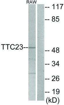 Anti-TTC23 antibody produced in rabbit affinity isolated antibody