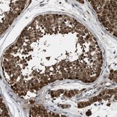 Anti-PPA1 antibody produced in rabbit Prestige Antibodies&#174; Powered by Atlas Antibodies, affinity isolated antibody, buffered aqueous glycerol solution, Ab1