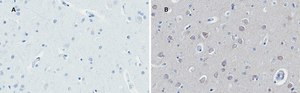 Anti-Huntingtin Protein Antibody, clone 1M11, ZooMAb&#174; Rabbit Monoclonal recombinant, expressed in HEK 293 cells
