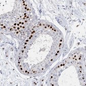 Anti-H2AFY2 antibody produced in rabbit Prestige Antibodies&#174; Powered by Atlas Antibodies, affinity isolated antibody, buffered aqueous glycerol solution