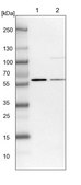 Anti-UMPS antibody produced in rabbit Prestige Antibodies&#174; Powered by Atlas Antibodies, affinity isolated antibody, buffered aqueous glycerol solution