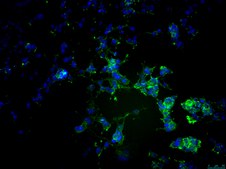 Oli-neu Mouse Oligodendroglial Precursor Cell Line