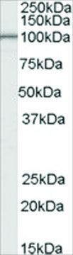 Anti-LARP2 antibody produced in goat affinity isolated antibody, buffered aqueous solution