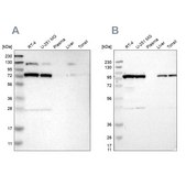 Anti-GARS antibody produced in rabbit Prestige Antibodies&#174; Powered by Atlas Antibodies, affinity isolated antibody, buffered aqueous glycerol solution