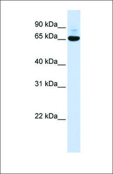Anti-CNOT4 antibody produced in rabbit affinity isolated antibody