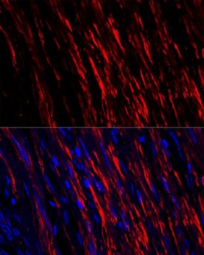 Anti-alpha smooth muscle actin antibody produced in rabbit