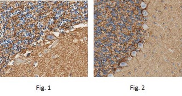 Anti-Sodium Pump Subunit alpha-2 Antibody from rabbit, purified by affinity chromatography