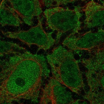 Anti-Cckar Antibody Produced In Rabbit Prestige Antibodies&#174; Powered by Atlas Antibodies, affinity isolated antibody, buffered aqueous glycerol solution