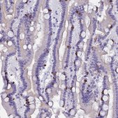 Anti-MUC13 antibody produced in rabbit Prestige Antibodies&#174; Powered by Atlas Antibodies, affinity isolated antibody, buffered aqueous glycerol solution