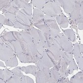 Anti-AGER antibody produced in rabbit Prestige Antibodies&#174; Powered by Atlas Antibodies, affinity isolated antibody, buffered aqueous glycerol solution