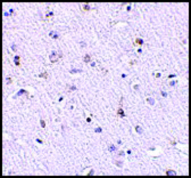 Anti-Nanos1 (ab1) antibody produced in rabbit affinity isolated antibody, buffered aqueous solution